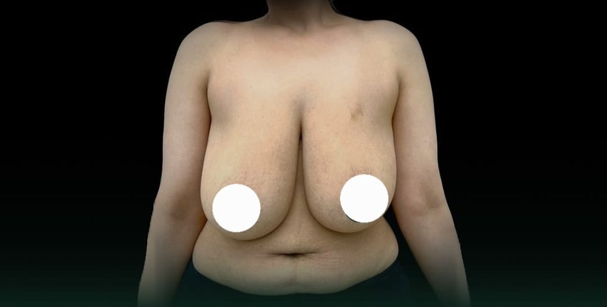 Large Breasts Exposed