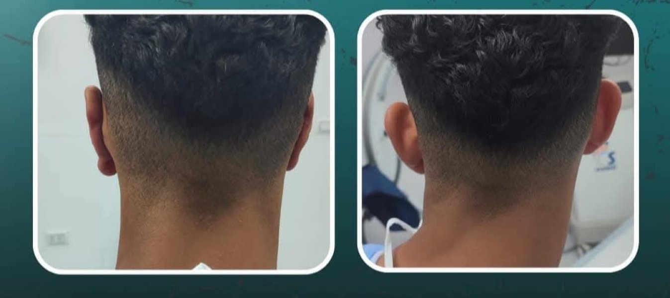 Back Of Mans Haircut