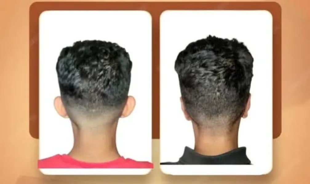 Back Haired Mentheimageshowstwomenwithshorthairviewedfrombehindthemanonthelefthasshortdarkhairandwearsaredshirtwhilethemanontherightalsohasshortdarkhairbutwearsablackshirtbotharesetagainstawhitebackgroundwithinroundedrectangular