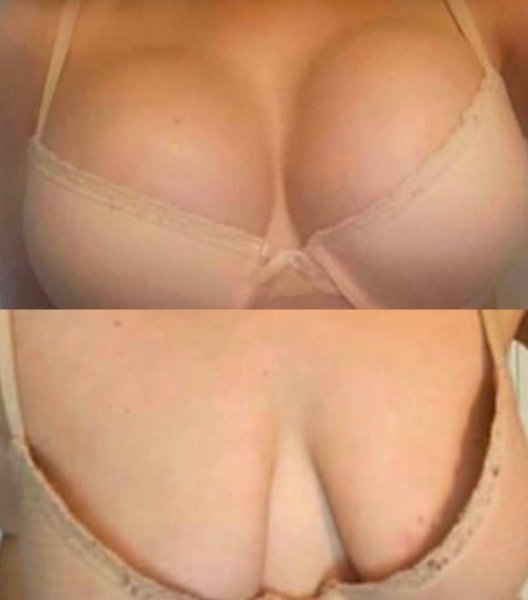 Beige Lace Bra Before After