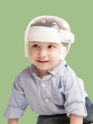 Brain Flattening and Deformation in Newborns​