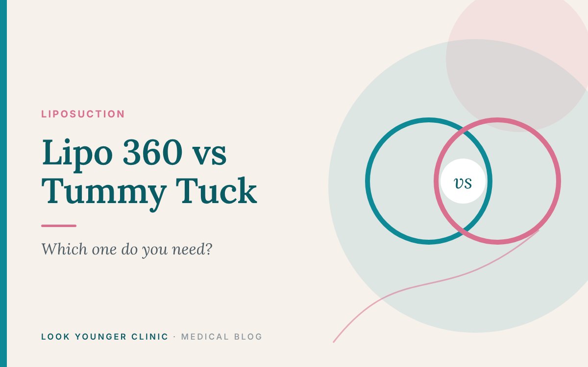Lipo 360 vs Tummy Tuck: Which One Do You Need? – Look Younger Clinic